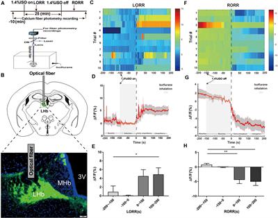 Lateral Habenula Glutamatergic Neurons Modulate Isoflurane Anesthesia in Mice